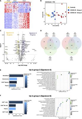 Immune Signature Linked to COVID-19 Severity: A SARS-Score for Personalized Medicine